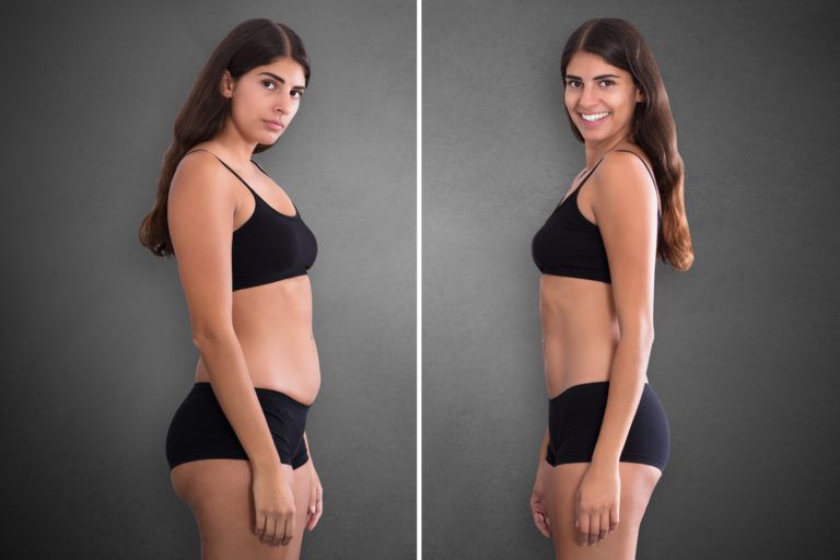 Five Benefits of Vaser® Liposuction vs. Traditional Liposuction