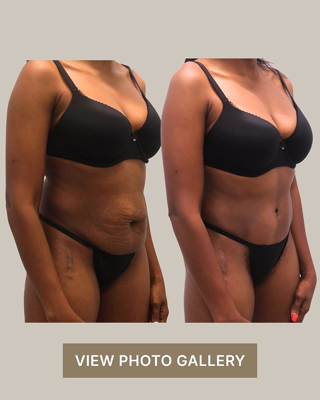 Before and after body transformation comparison.