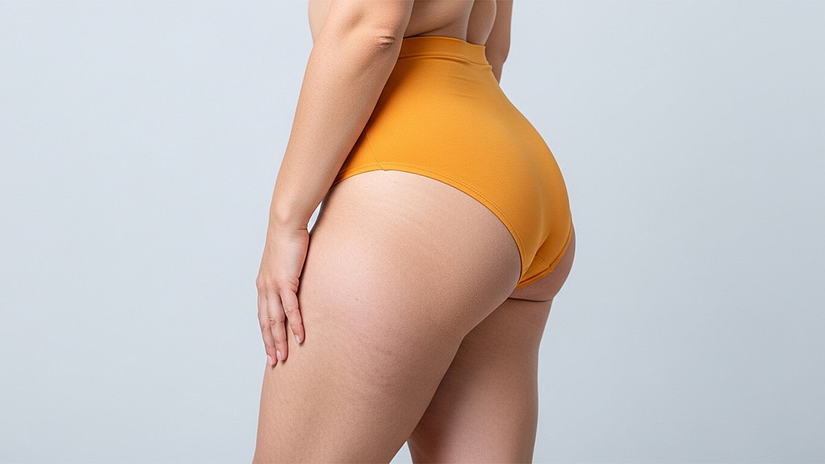 How to Lose Thigh Fat: A Thoughtful, Medical Perspective on a Common Concern