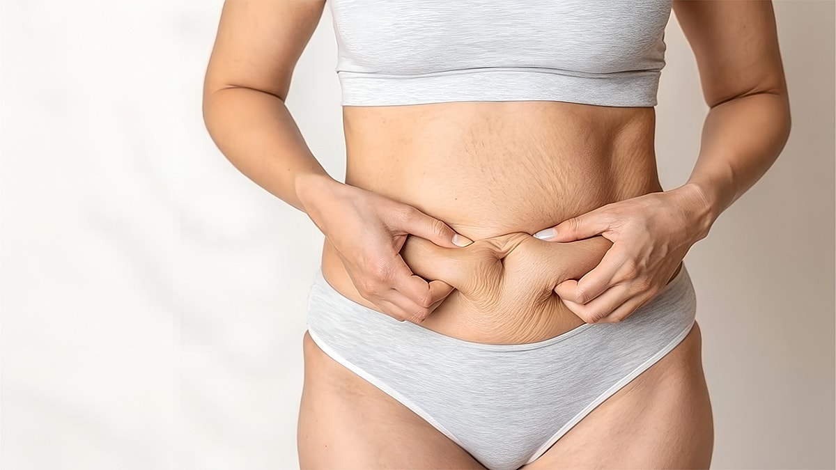 Mini vs. Full Tummy Tuck in Houston