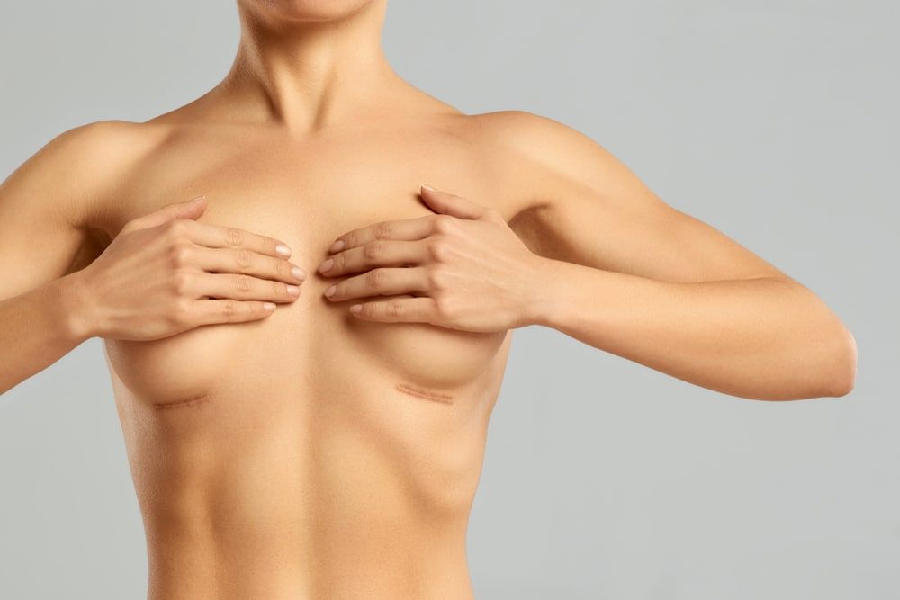 Surgical Scars: Expectations and Care