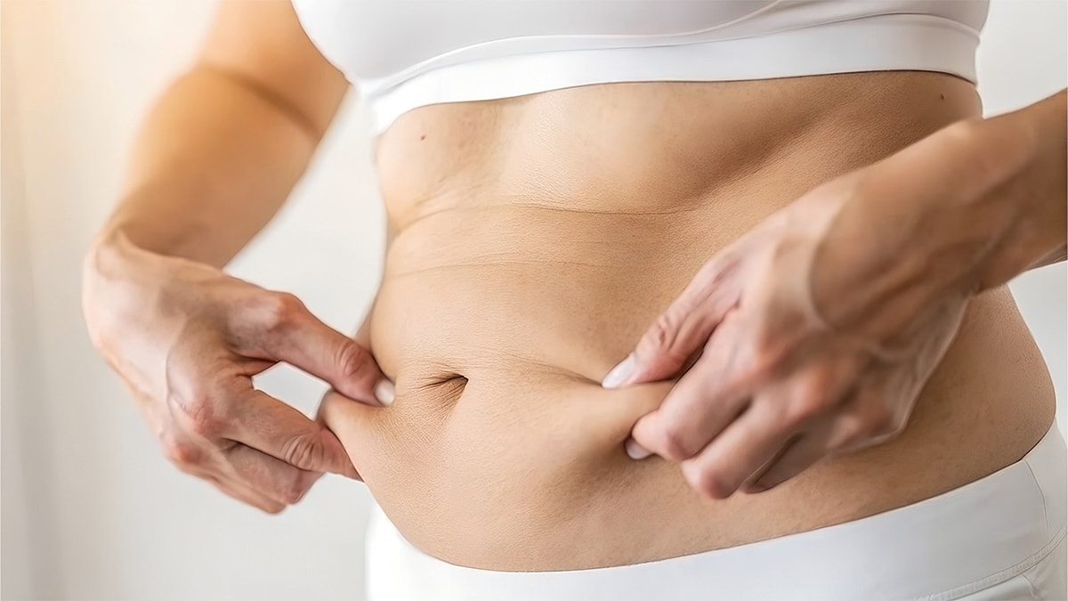 I Have Botched Results From Liposuction- What Are My Options Blgo Featured Image - Woman pinching skin on abdomen.