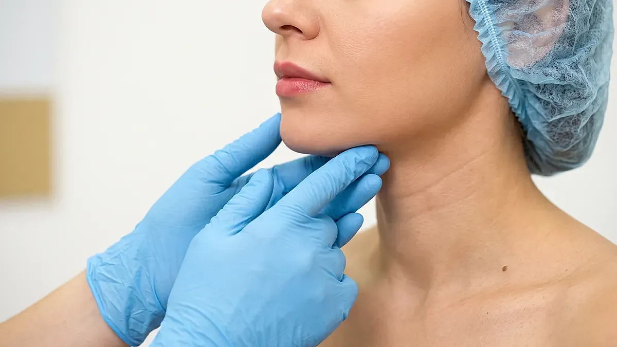 Chin liposuction in Houston for submental fullness and jawline definition