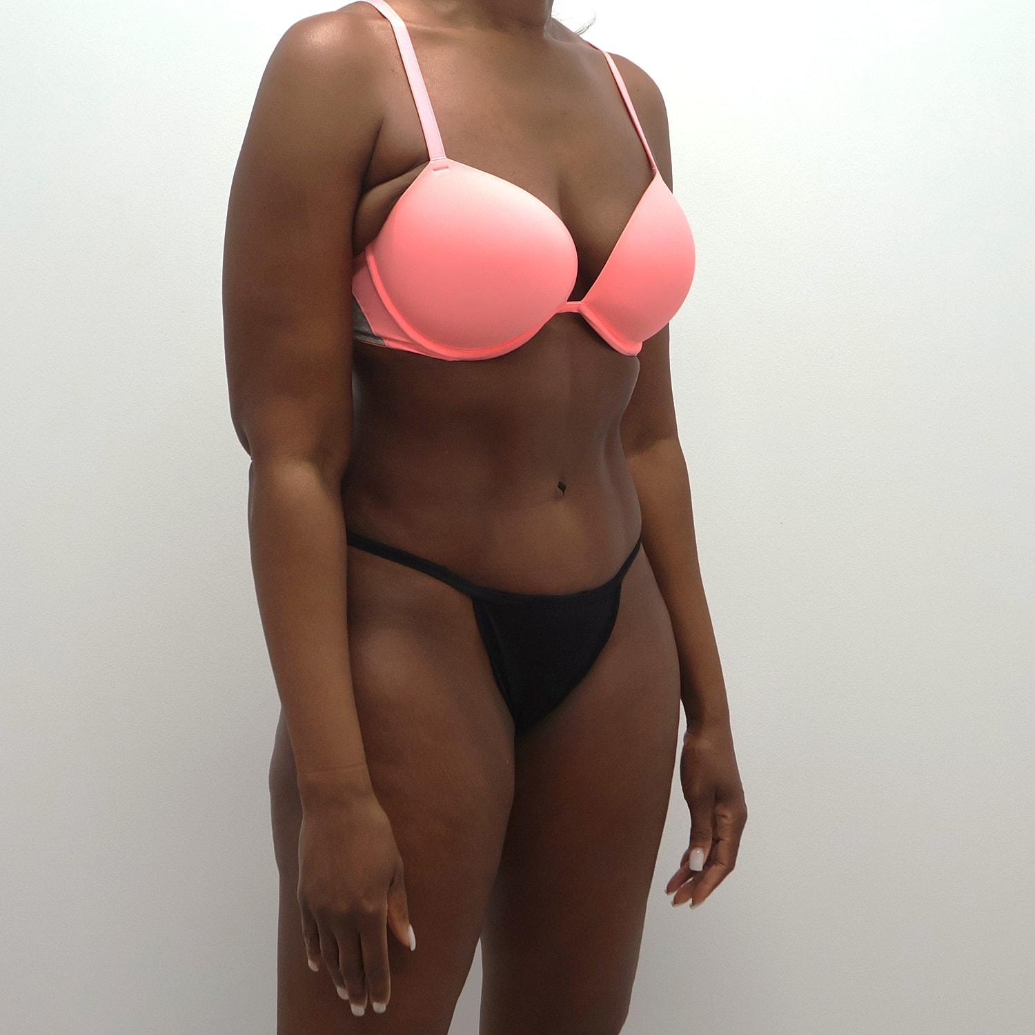 Tummy Tuck Before & After