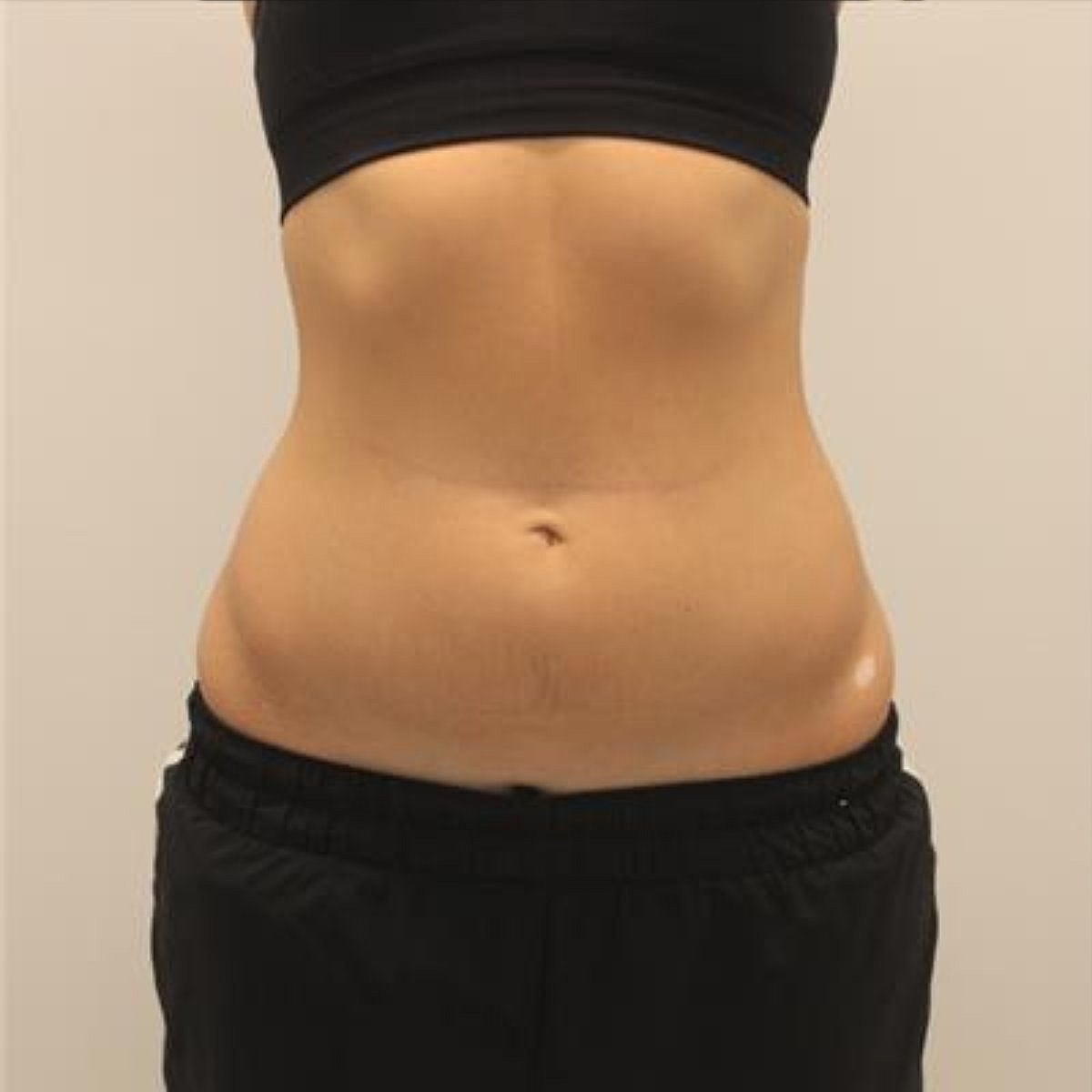 Evolve Before & After