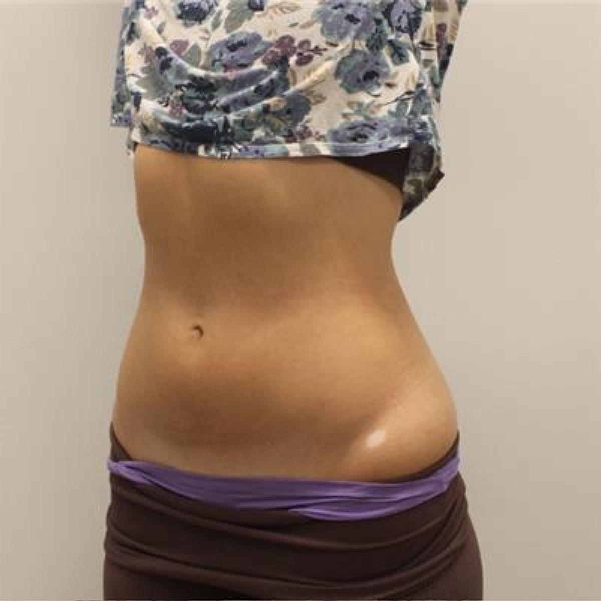 Evolve Before & After