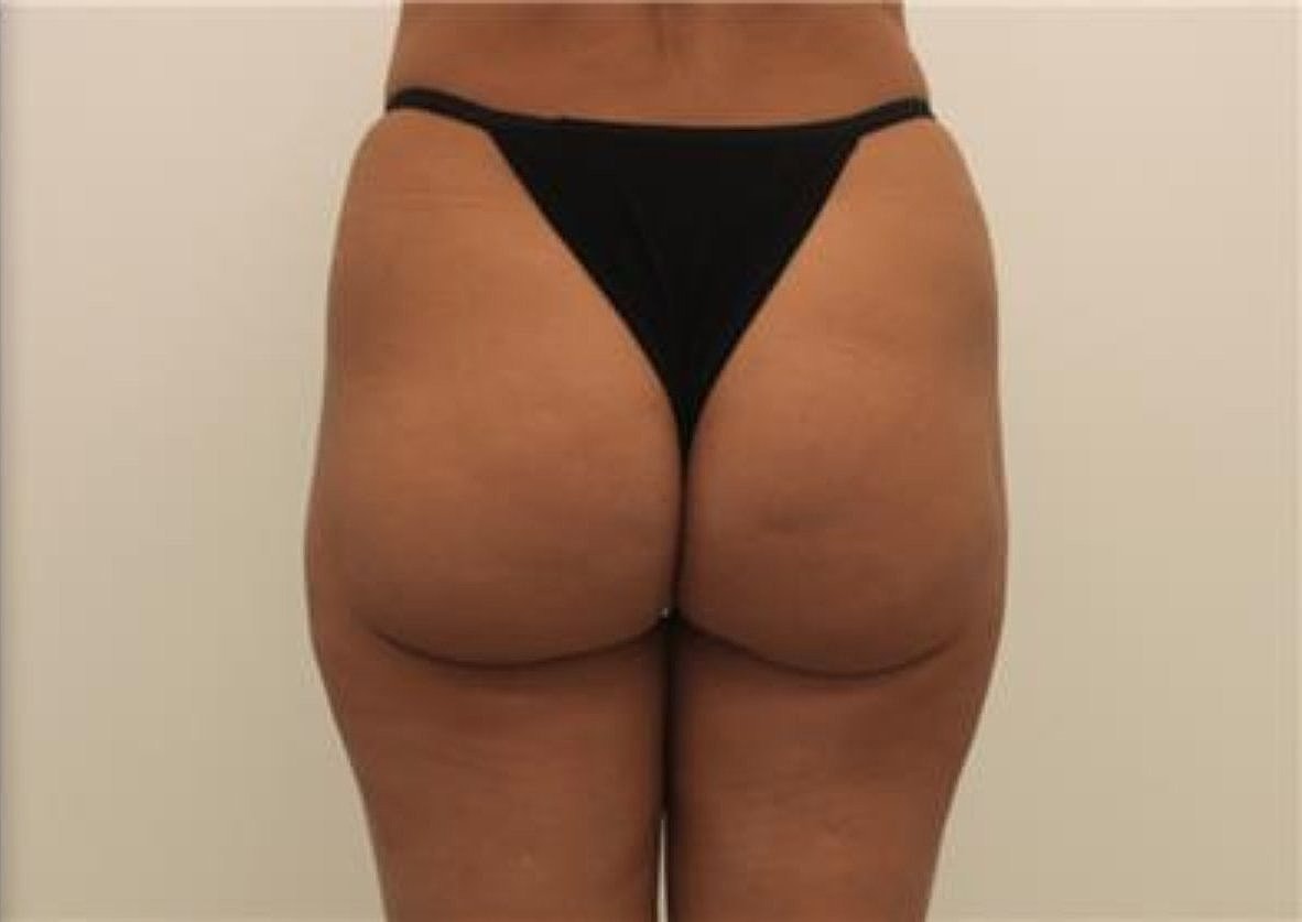 Evolve Before & After