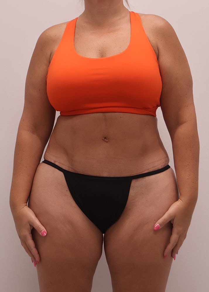 MEDICAL WEIGHT LOSS PROGRAM Before & After