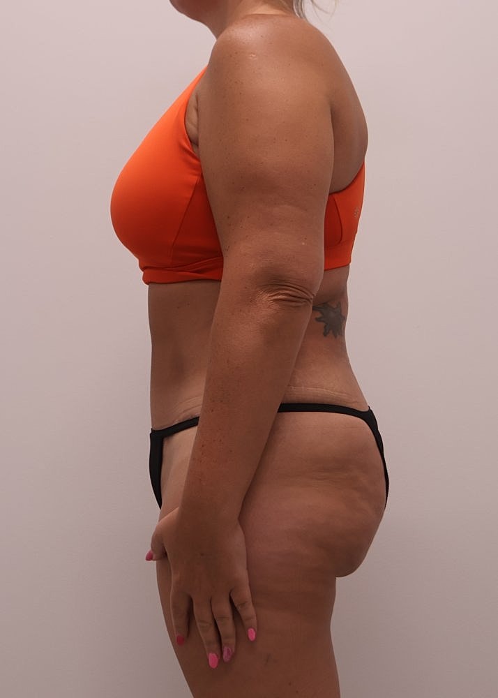 MEDICAL WEIGHT LOSS PROGRAM Before & After