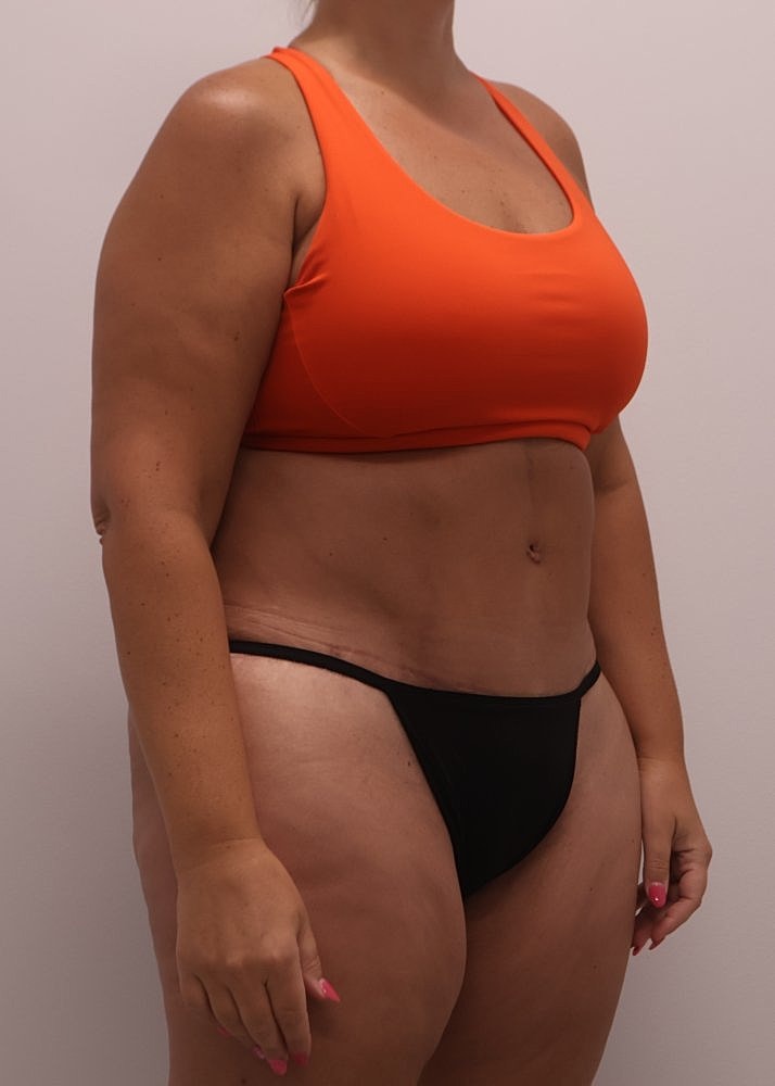 MEDICAL WEIGHT LOSS PROGRAM Before & After