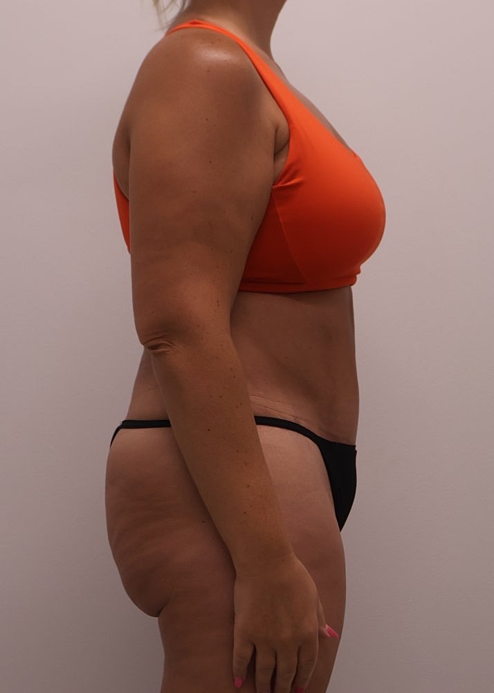 MEDICAL WEIGHT LOSS PROGRAM Before & After