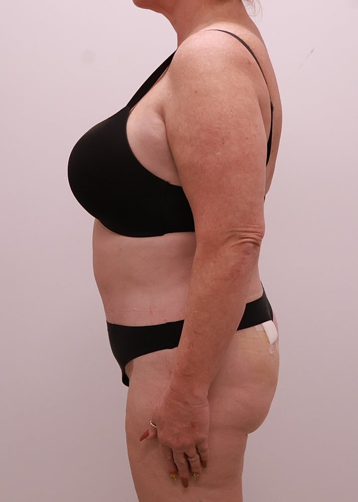 MEDICAL WEIGHT LOSS PROGRAM Before & After