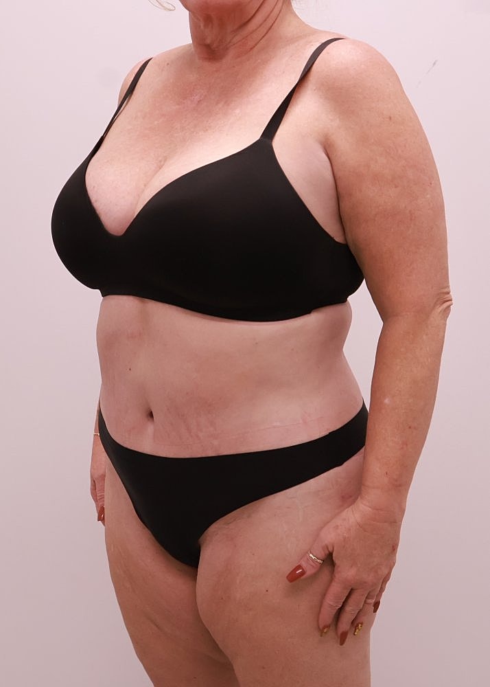 MEDICAL WEIGHT LOSS PROGRAM Before & After