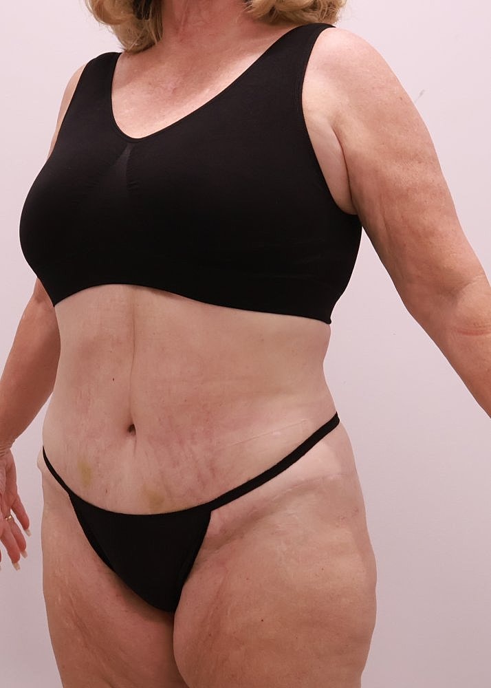 MEDICAL WEIGHT LOSS PROGRAM Before & After