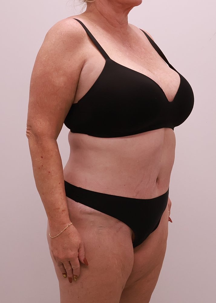 MEDICAL WEIGHT LOSS PROGRAM Before & After