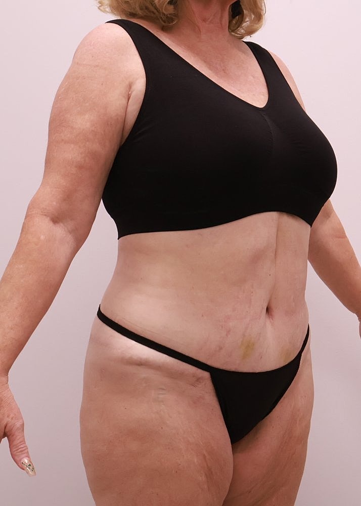 MEDICAL WEIGHT LOSS PROGRAM Before & After