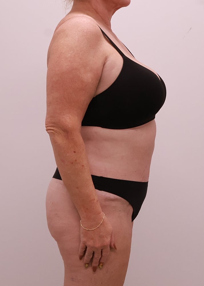 MEDICAL WEIGHT LOSS PROGRAM Before & After