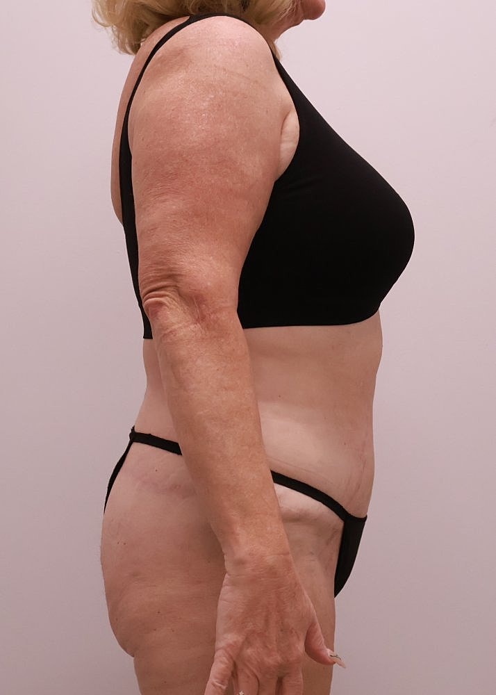 MEDICAL WEIGHT LOSS PROGRAM Before & After