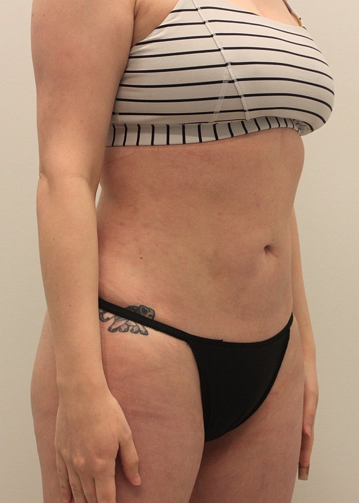 MEDICAL WEIGHT LOSS PROGRAM Before & After