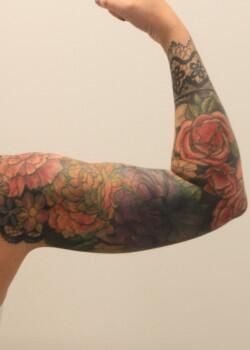 Arm Liposuction Before & After