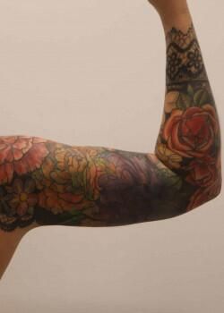 Arm Liposuction Before & After