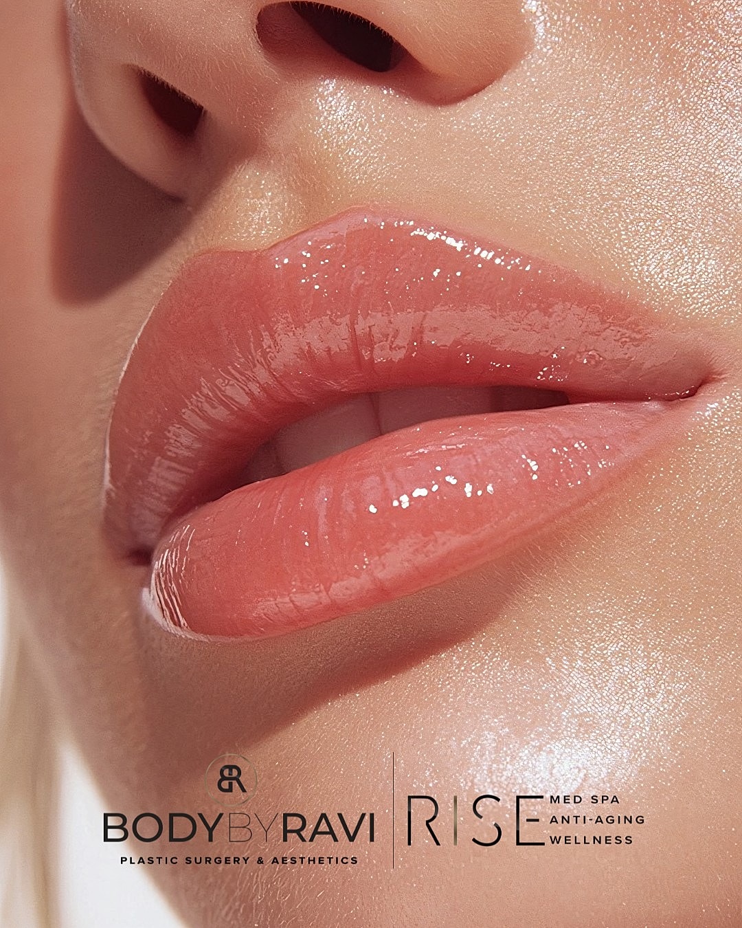 Glossy lips showcasing beauty and wellness.