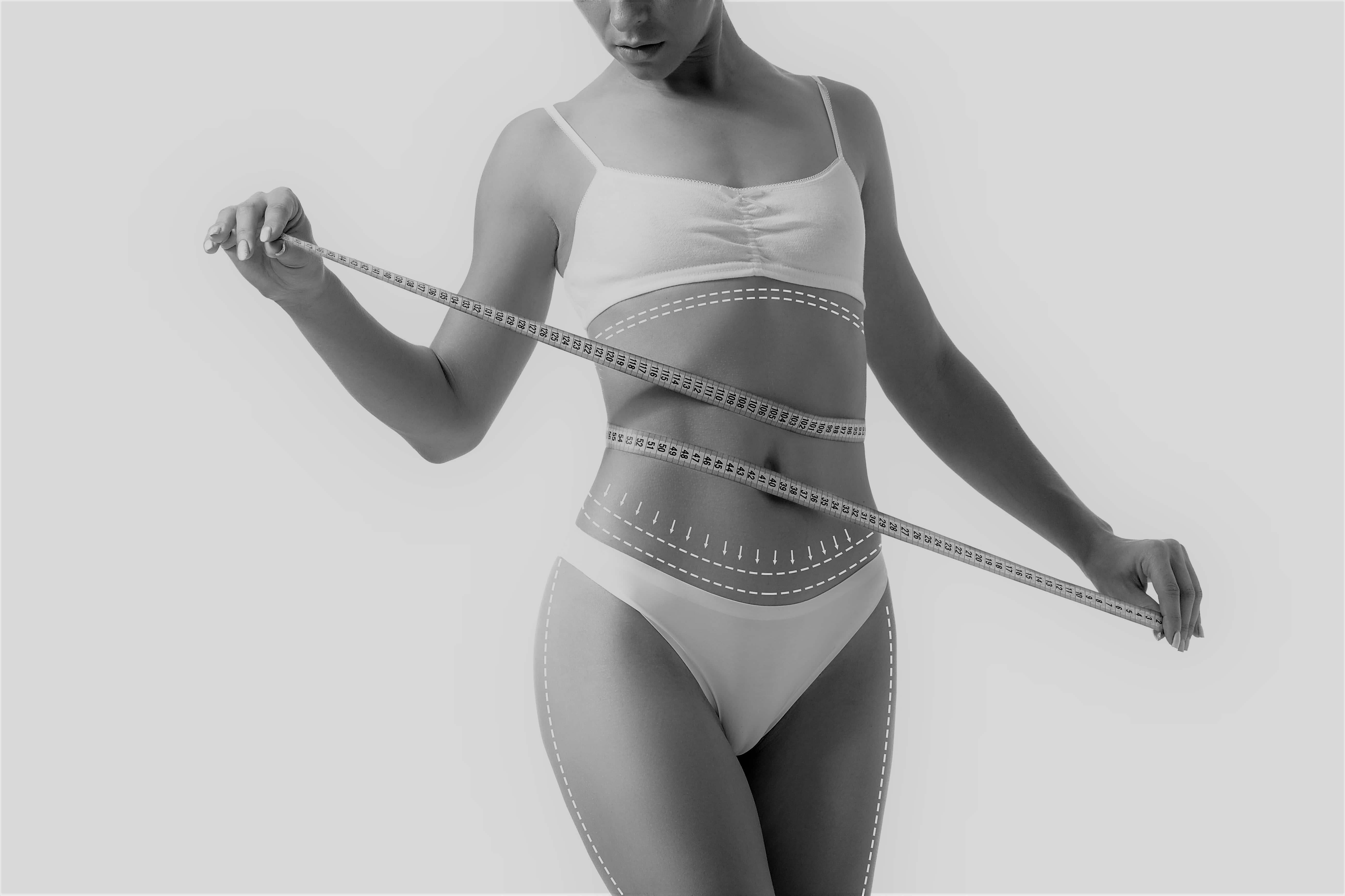Female body with the drawing arrows on it isolated on white. Fat lose, liposuction