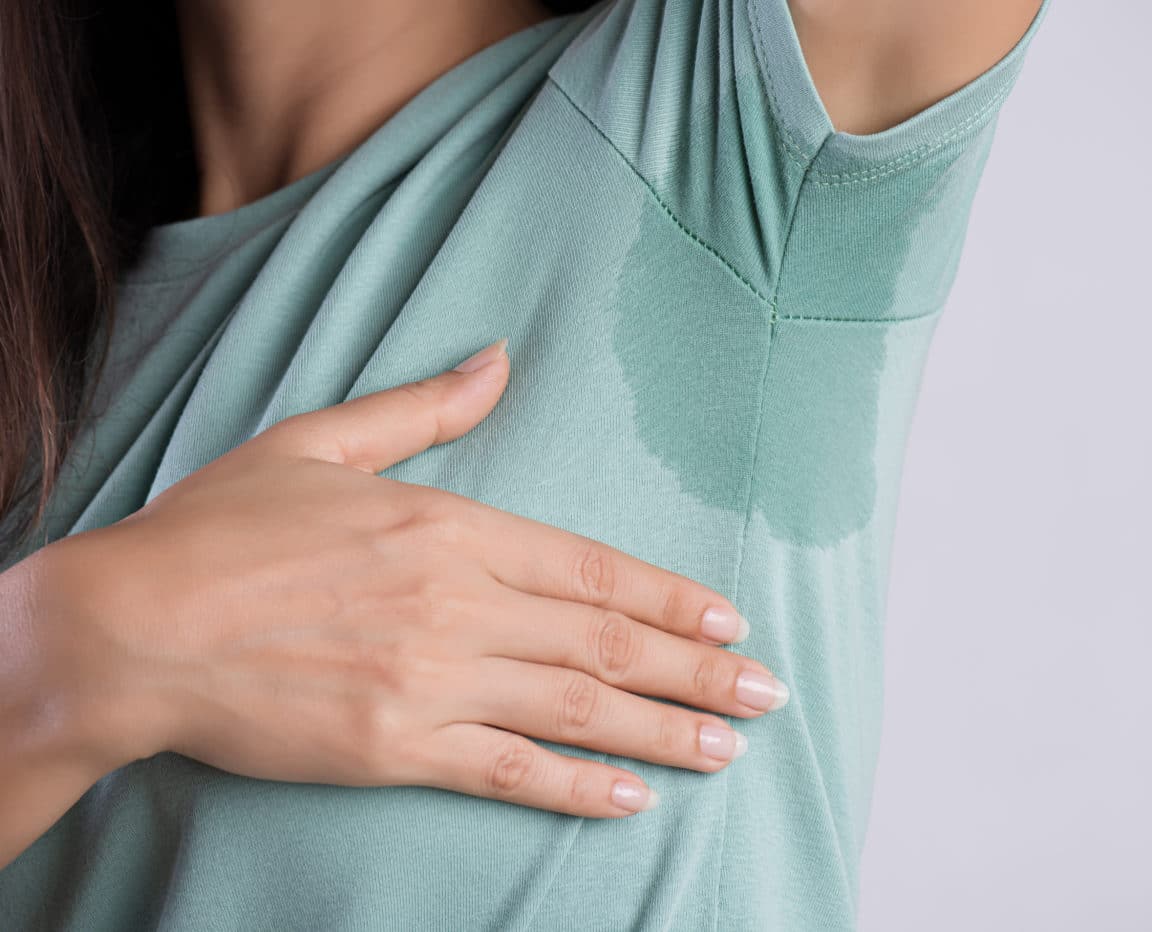 How to Reduce Underarm Sweat With miraDry®